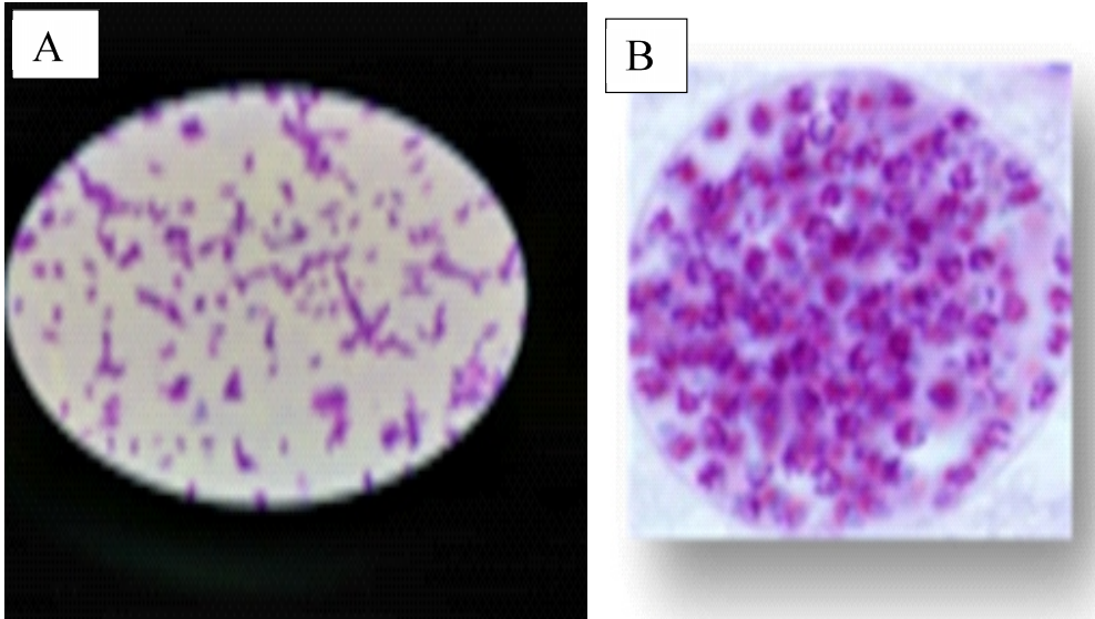 Investigation of Toxoplasma gondii in chicken products in Nineveh  Governorate, Iraq